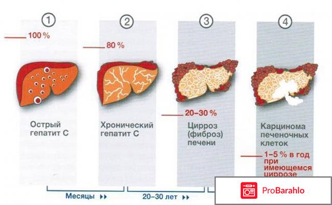 Mpiviropack (Совосбувир) отрицательные отзывы