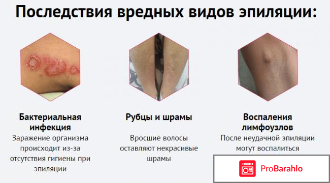 Паста для шугаринга epilogue отрицательные отзывы