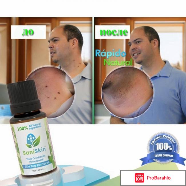 Сани скин от папиллом цена 