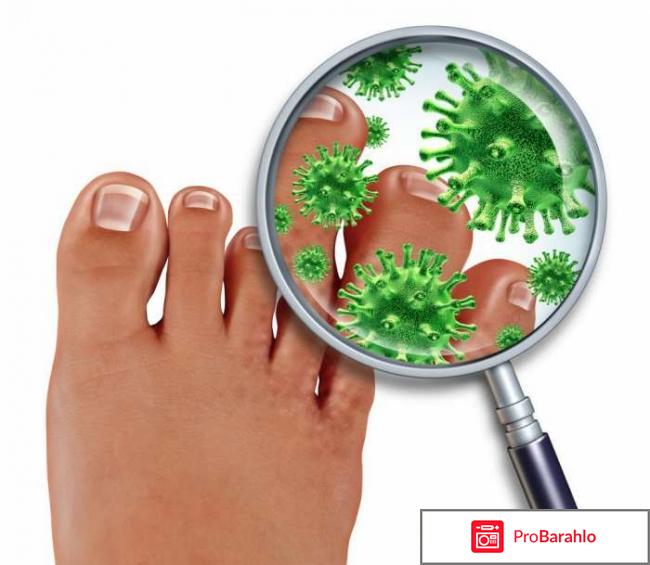 Стоп актив от грибка отзывы отрицательные отзывы