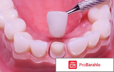 Зубные коронки какие лучше отзывы 