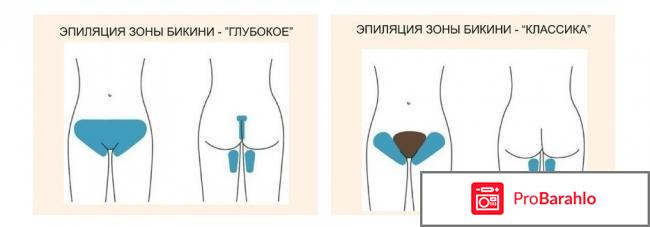 Почему женщины стали брить интимную зону отрицательные отзывы