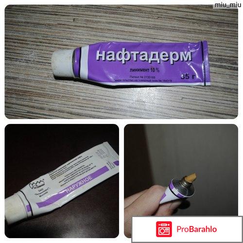 Отзывы мазь нафтадерм цена отрицательные отзывы