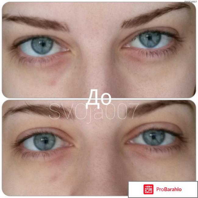 Гепариновая мазь от мешков под глазами 