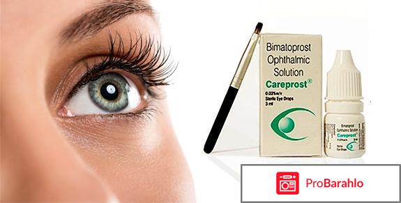 Bimatoprost ophthalmic solution careprost отрицательные отзывы