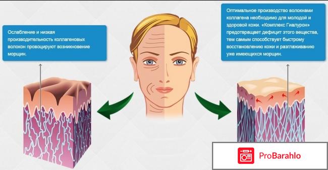 Гель гиалуроновой кислоты купить в аптеке обман