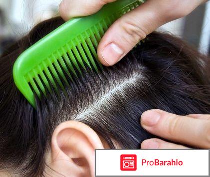 Педикулен ультра шампунь отзывы цена отрицательные отзывы