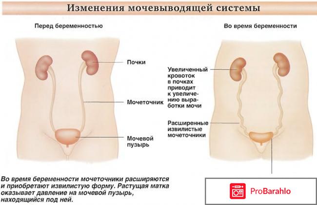 РОВАТИНЕКС аналоги обман