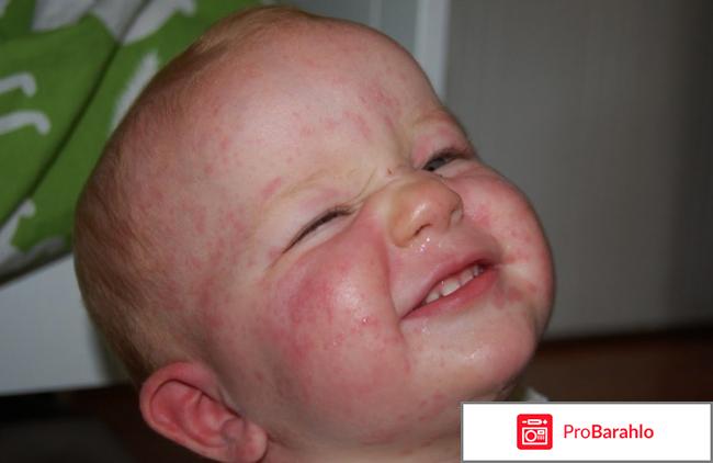 Зодак цена капли для детей отзывы отрицательные отзывы