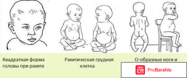 Аквадетрим инструкция по применению цена отзывы 