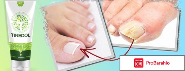 Тинедол отзывы обман или правда? отрицательные отзывы