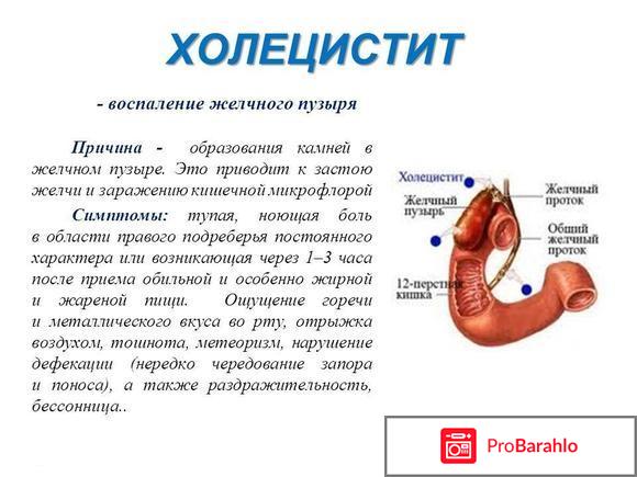 Болит под рёбрами с обеих сторон отрицательные отзывы