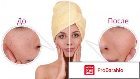 Imira peeling – пилинг для лица 