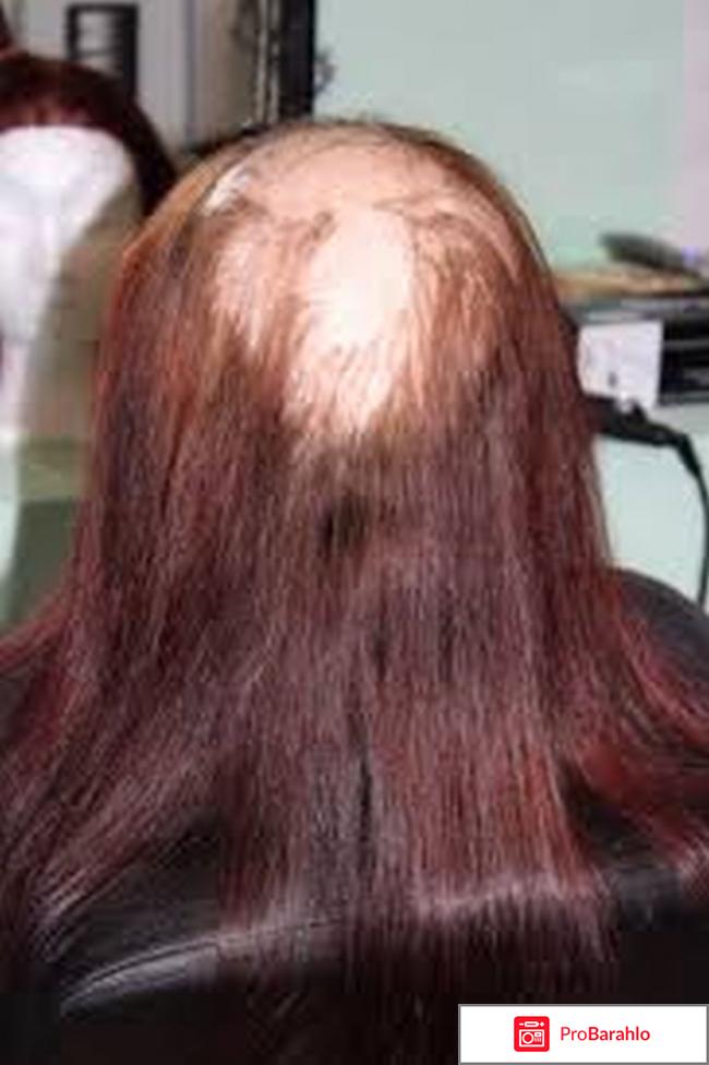 Наращивание волос последствия фото отрицательные отзывы