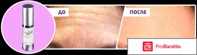 Максилифт цена и отзывы сколько стоит отрицательные отзывы