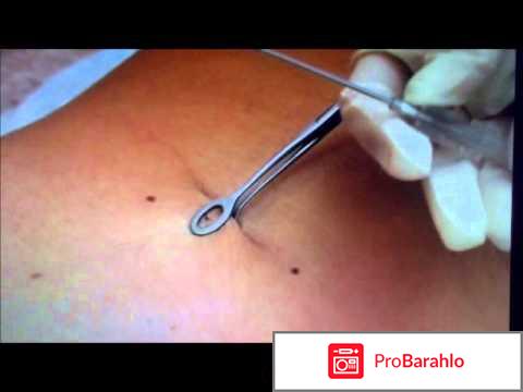 Как прокалывают пупок отрицательные отзывы