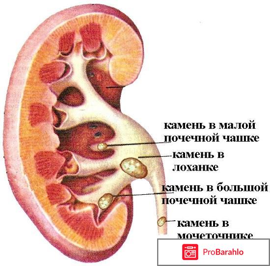 Холит инструкция по применению цена отзывы аналоги отрицательные отзывы