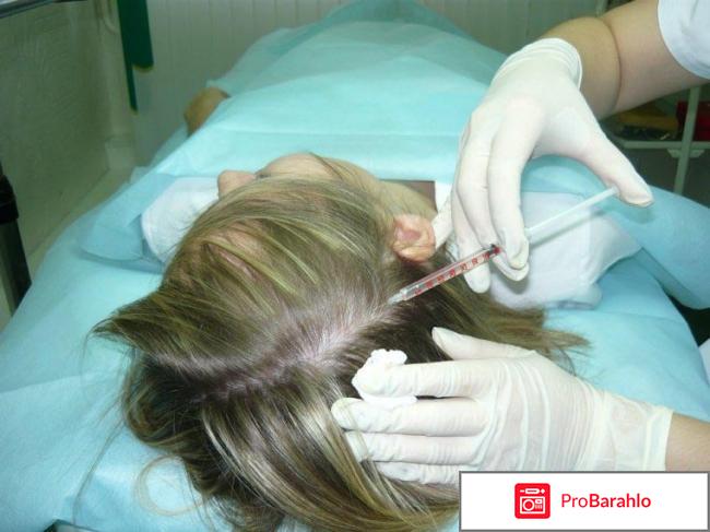 Мезо для волос отзывы 