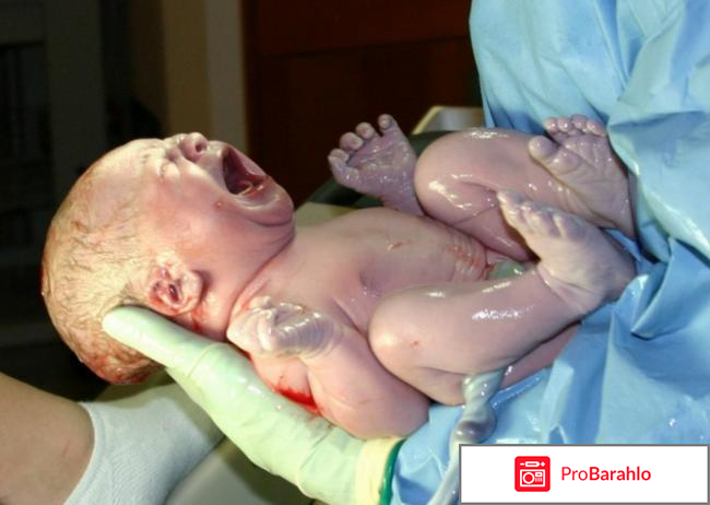 Тест на подтекание околоплодных вод обман