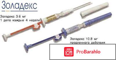 Золадекс инструкция по применению цена 