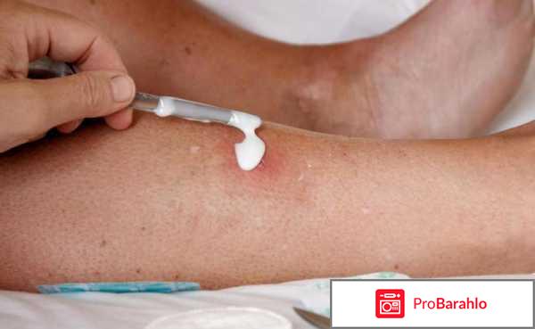 Стелланин мазь цена и эффективность отрицательные отзывы