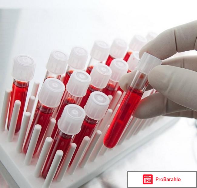 Болезни крови по анализу крови отзывы форум отрицательные отзывы