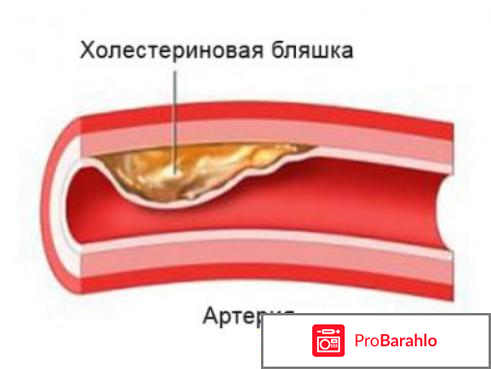 Атероклефит инструкция по применению цена отзывы аналоги 