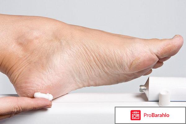 Ламизил спрей 