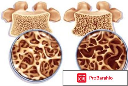 Артроцельс инструкция по применению цена аналоги отрицательные отзывы