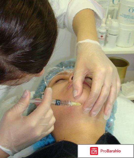 Липолитики для подбородка отзывы владельцев