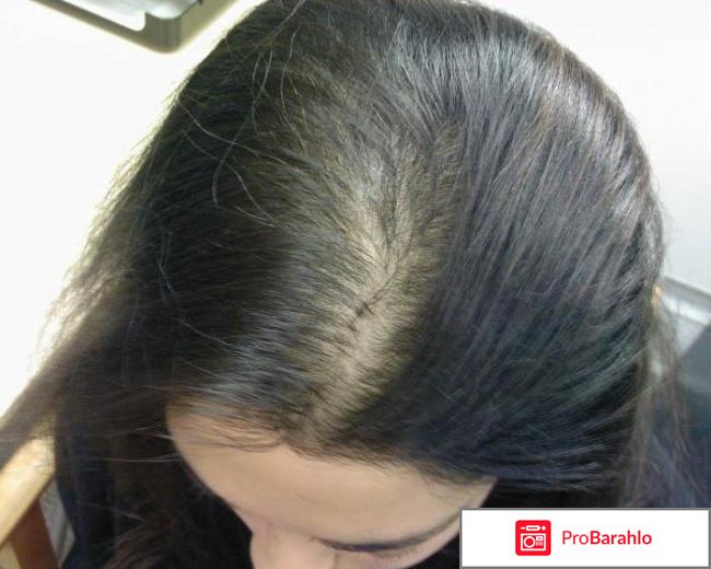 Пантовигар отзывы аналоги обман