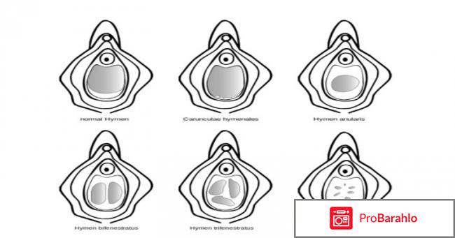 Как лишиться девственности без боли обман