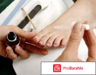 Креолин для людей лечение отзывы обман