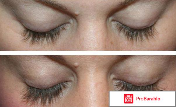 Карепрост для ресниц отзывы фото отрицательные отзывы