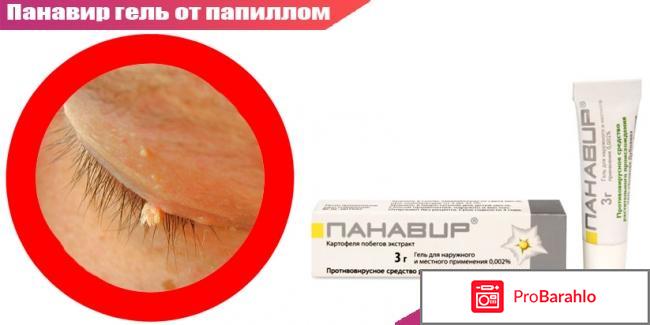 Панавир гель от папиллом отзывы цена 