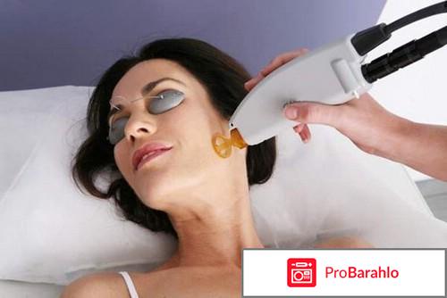 Лечение прыщей лазером 