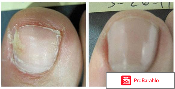 Экзомин (Exomin) фото