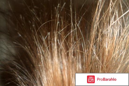 Деакура отзывы владельцев