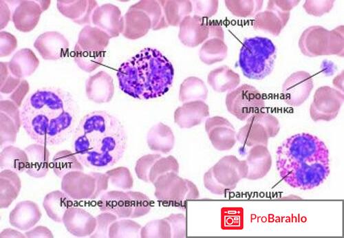 Нейпоген (Neupogen) отрицательные отзывы