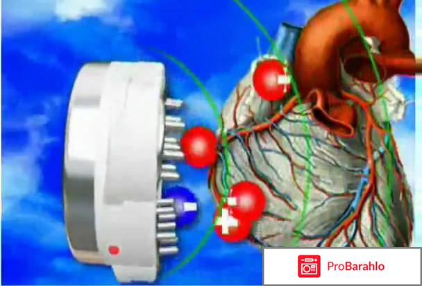 Аппарат антигипертоник цена обман