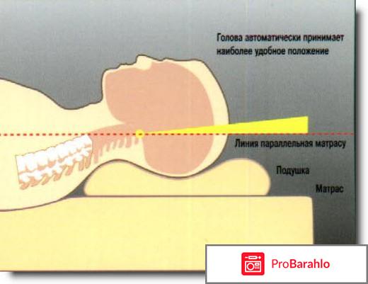 Доктор хорошев ортопедическая подушка 