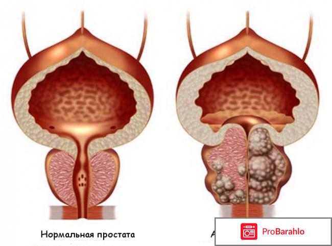 Простолайф отзывы обман