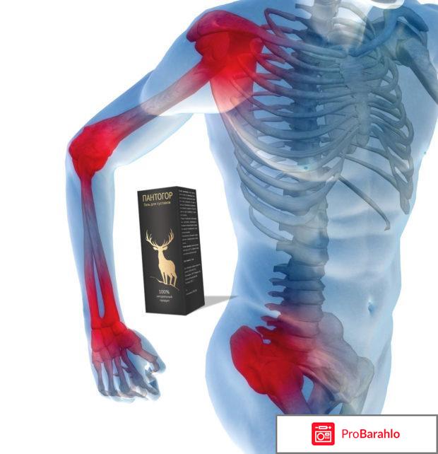 Пантовигар гель для суставов отрицательные отзывы