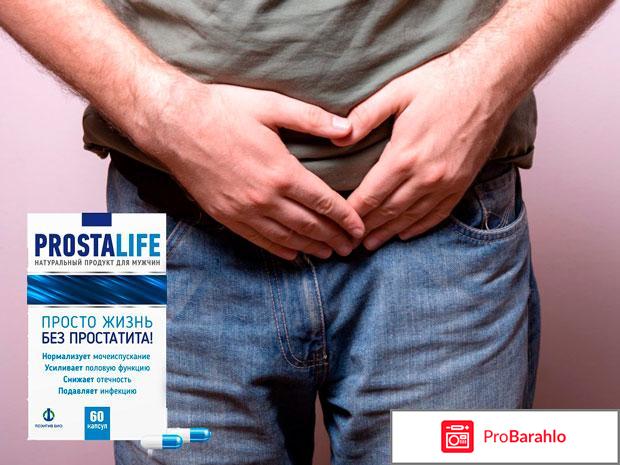 Простолайф отзывы 
