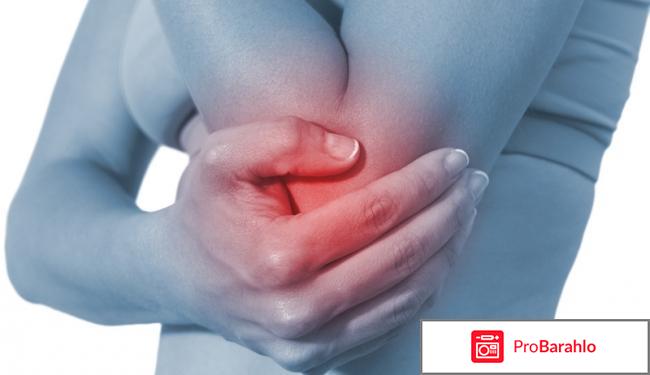 Крем Artrodex от боли в суставах: обзор, цена, купить 