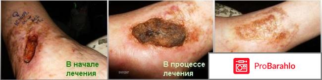 Асд фракция 2 применение для человека польза и вред обман