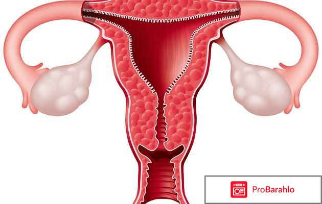 Отзывы женщин после удаления матки отрицательные отзывы