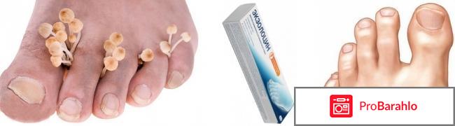 Гель против грибка Экзолоцин фото