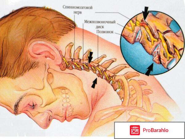 ВАЗОБРАЛ таблетки отрицательные отзывы