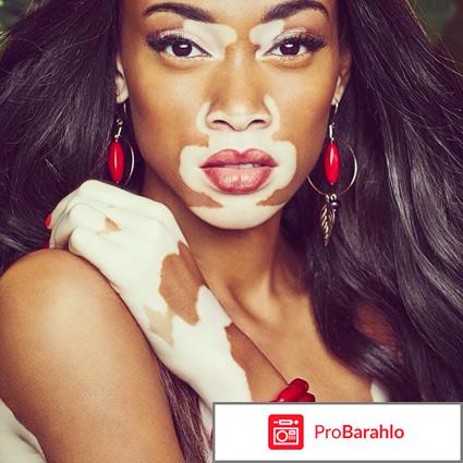 От витилиго sorig 